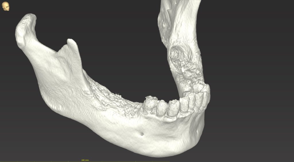 顎骨モデル３Dプリントサービス｜協和デンタル・ラボラトリー 千葉県の歯科技工所